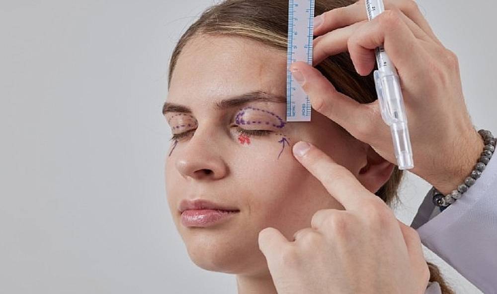 Sarkan G&ouml;z Kapakları: Estetik Bir İhtiya&ccedil; mı,   Yoksa Ciddi Bir G&ouml;rme Sorunu mu?