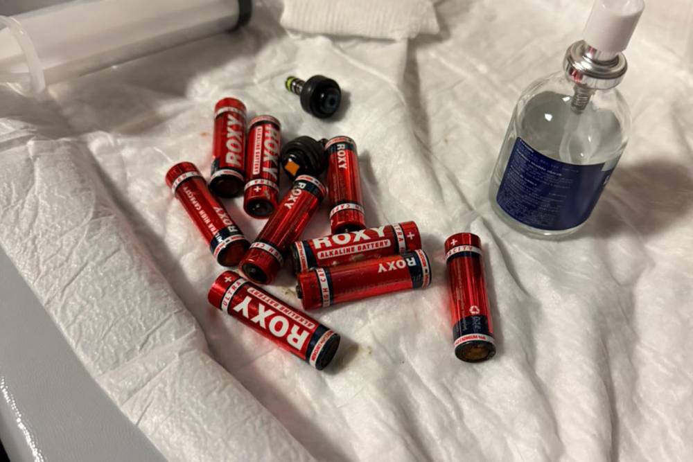 Bir kişi yuttuğu 9 kalem pil endoskopiyle &ccedil;ıkarıldı